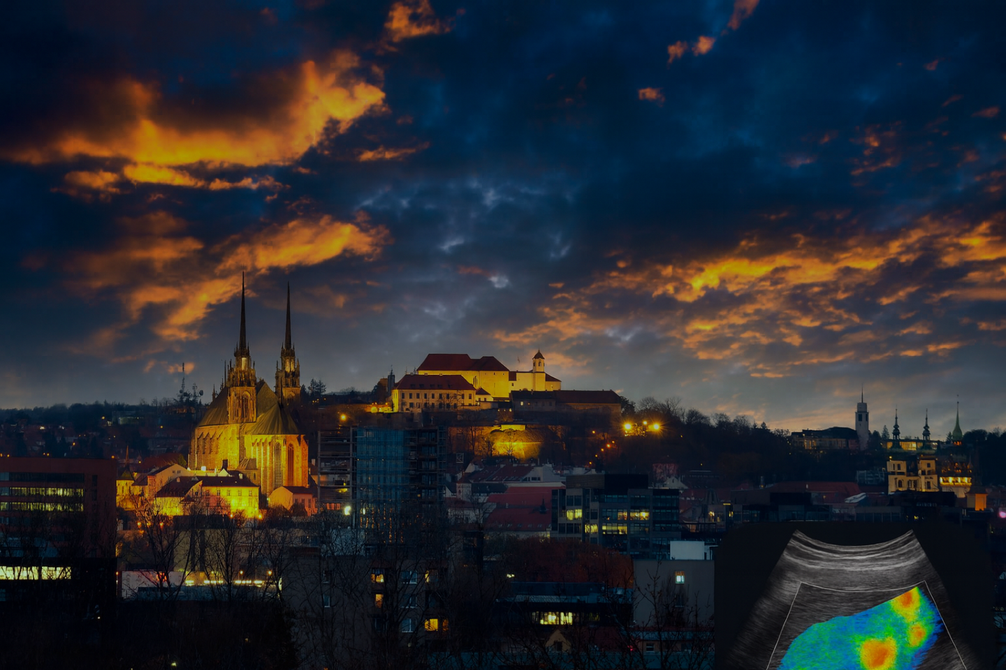 68. sjezd českých a slovenských revmatologů
